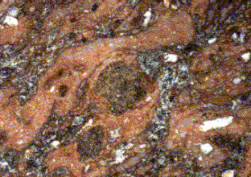 illustration brèche